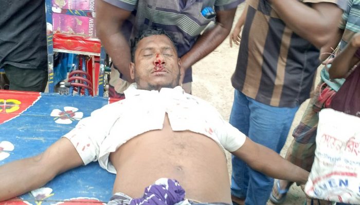 শৈলকুপায় পেঁয়াজের হাটে মারামারি, আহত ১